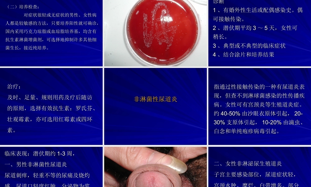常见性病.ppt