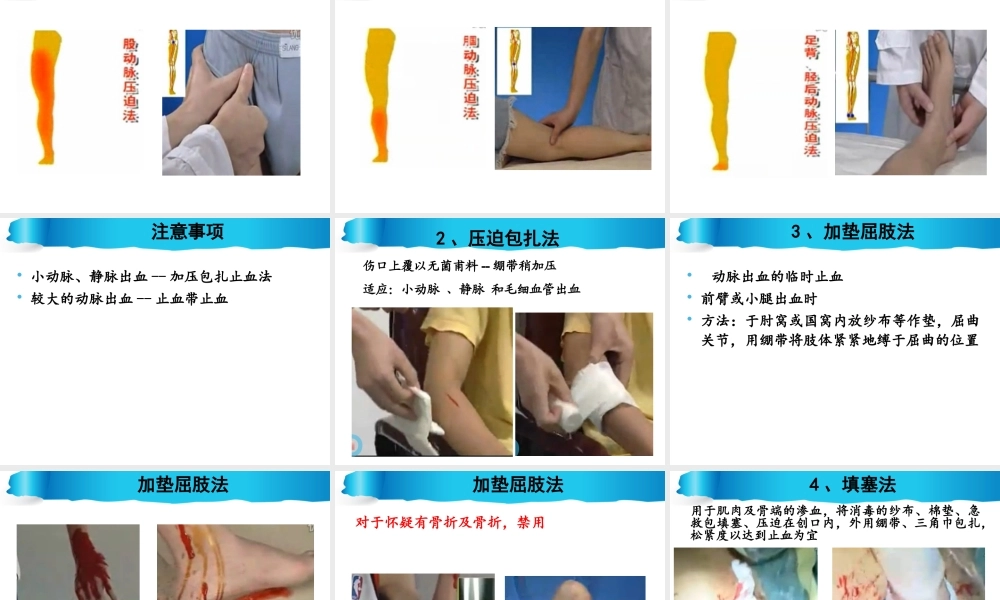 开放性伤口的止血..ppt