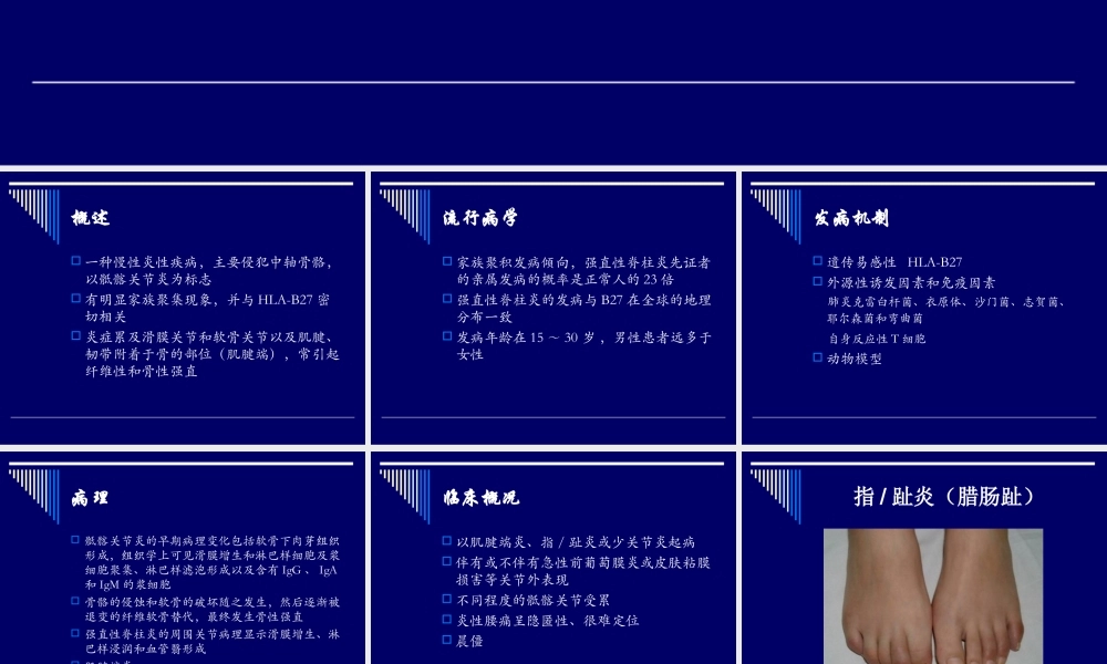 强直性脊柱炎(精).ppt