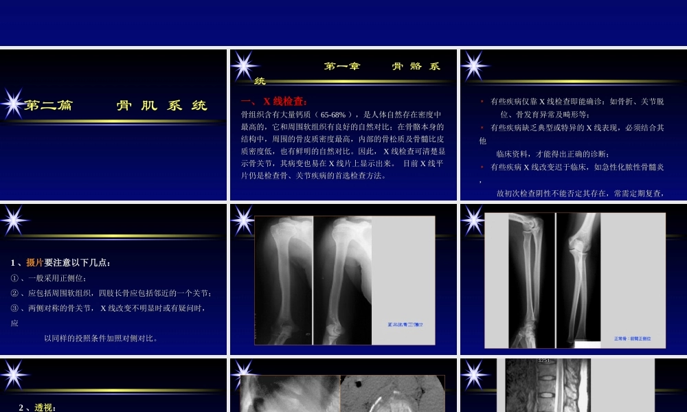 影像学骨肌系统.ppt