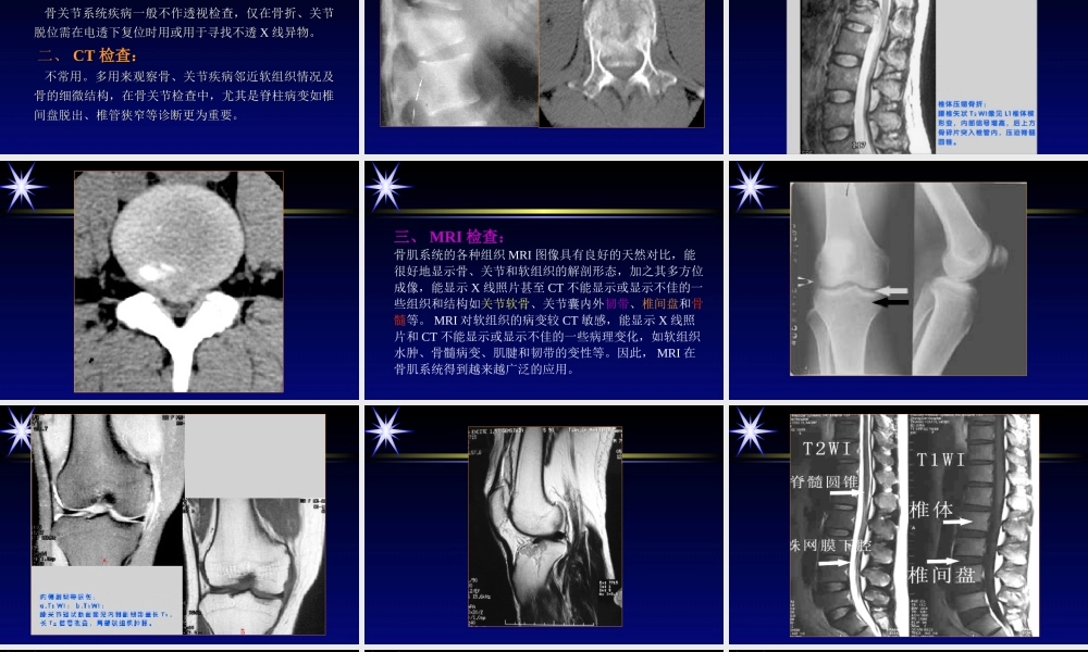 影像学骨肌系统.ppt