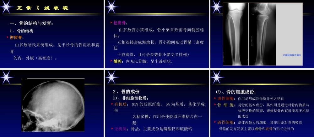 影像学骨肌系统.ppt
