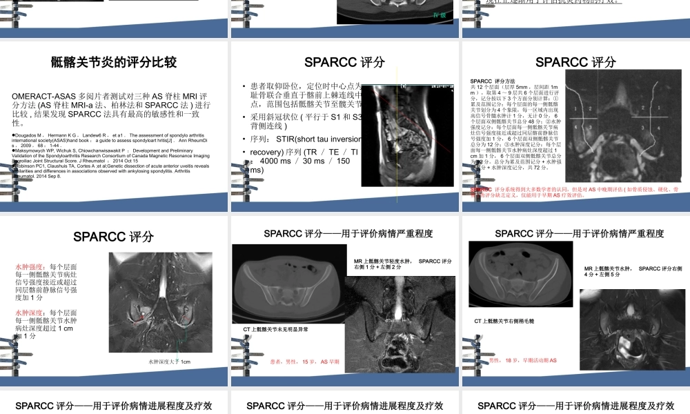 强直性脊柱炎MRI评分.ppt