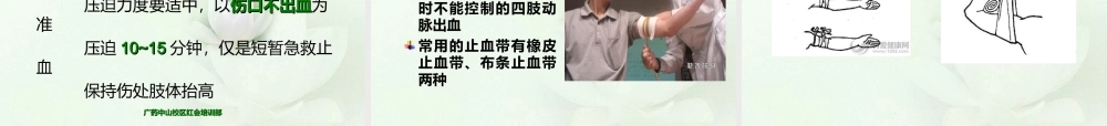 急救四项之止血和包扎.ppt