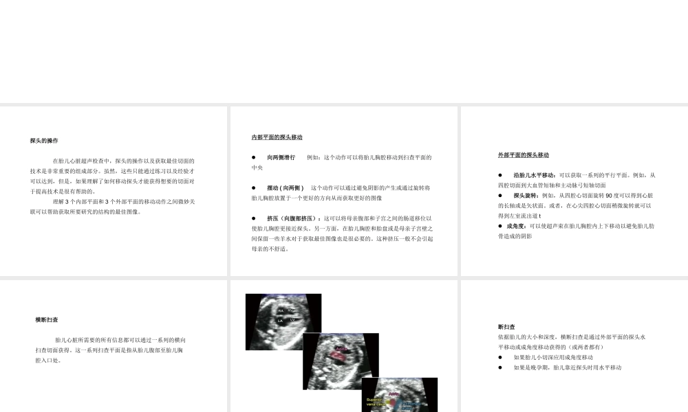 如何获得胎儿心脏切面.ppt