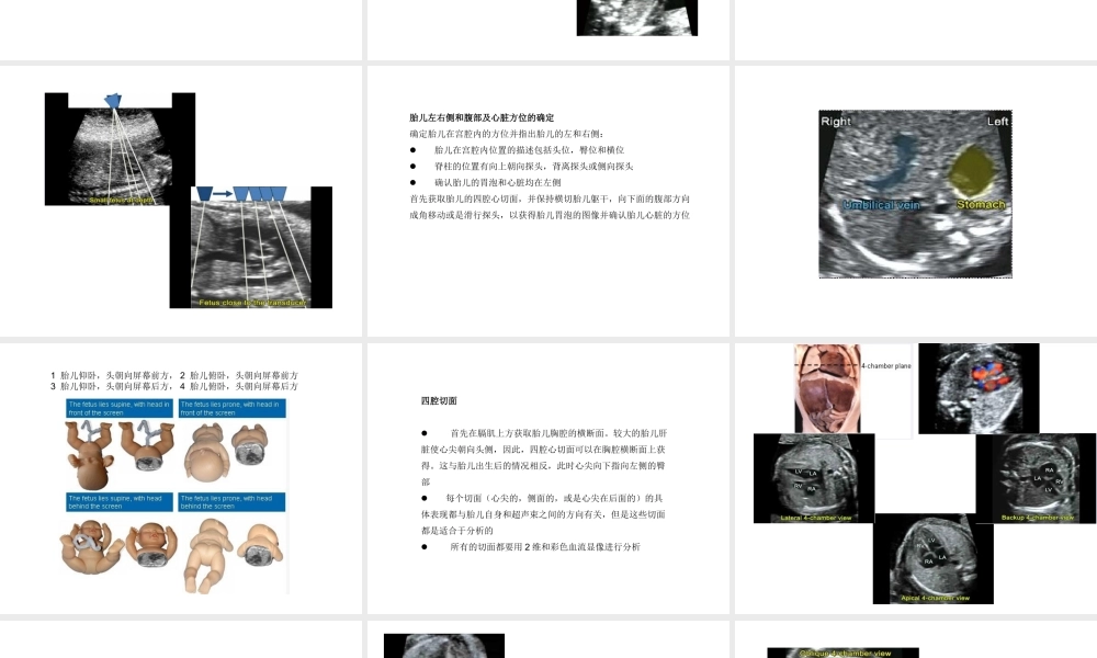 如何获得胎儿心脏切面.ppt