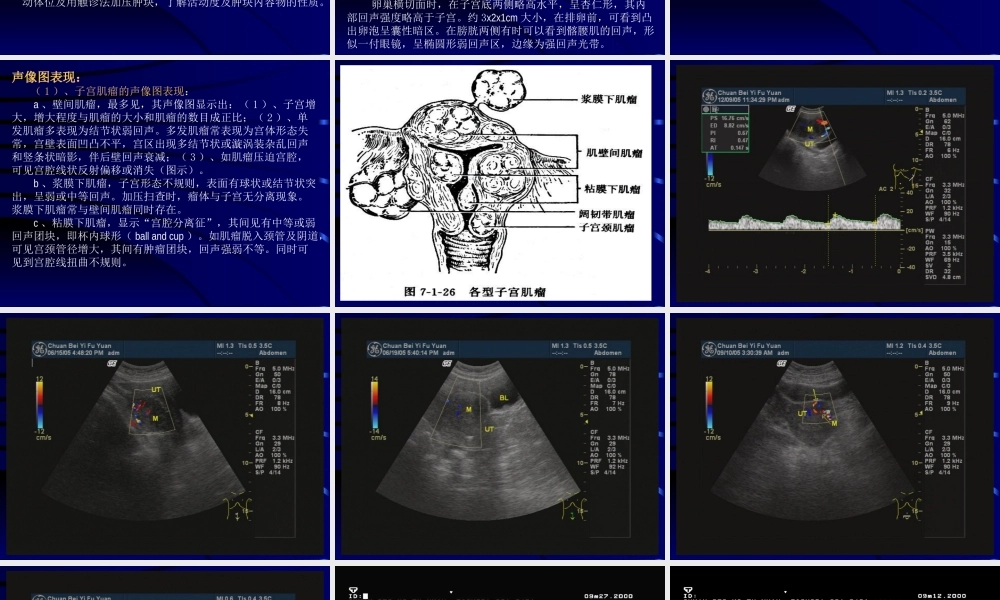 妇科超声检查.ppt