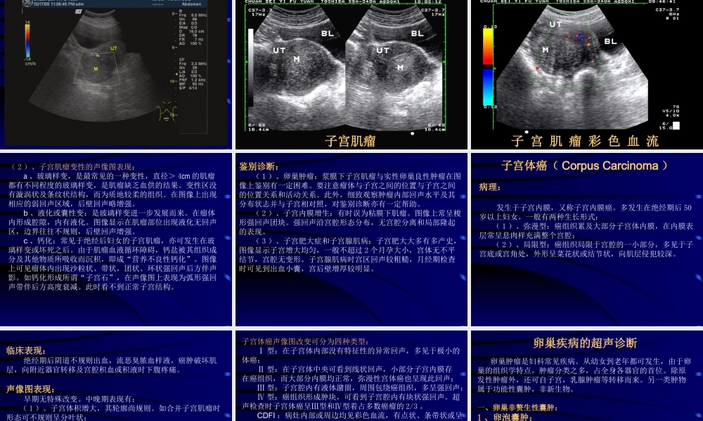 妇科超声检查.ppt