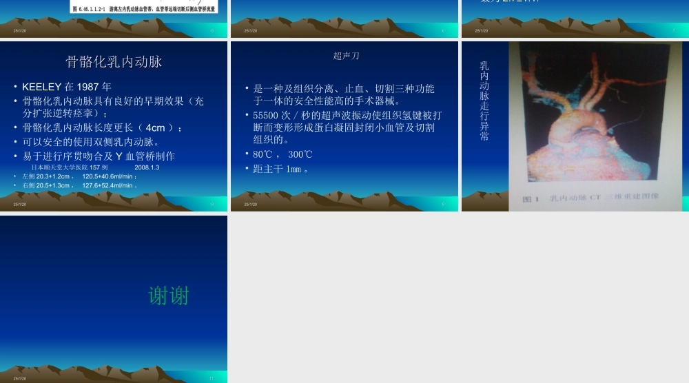 如何获取乳内动脉.ppt