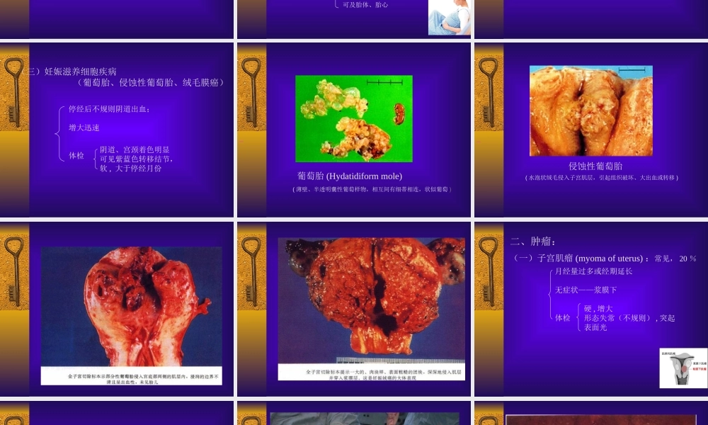 妇科-盆腔肿块.ppt