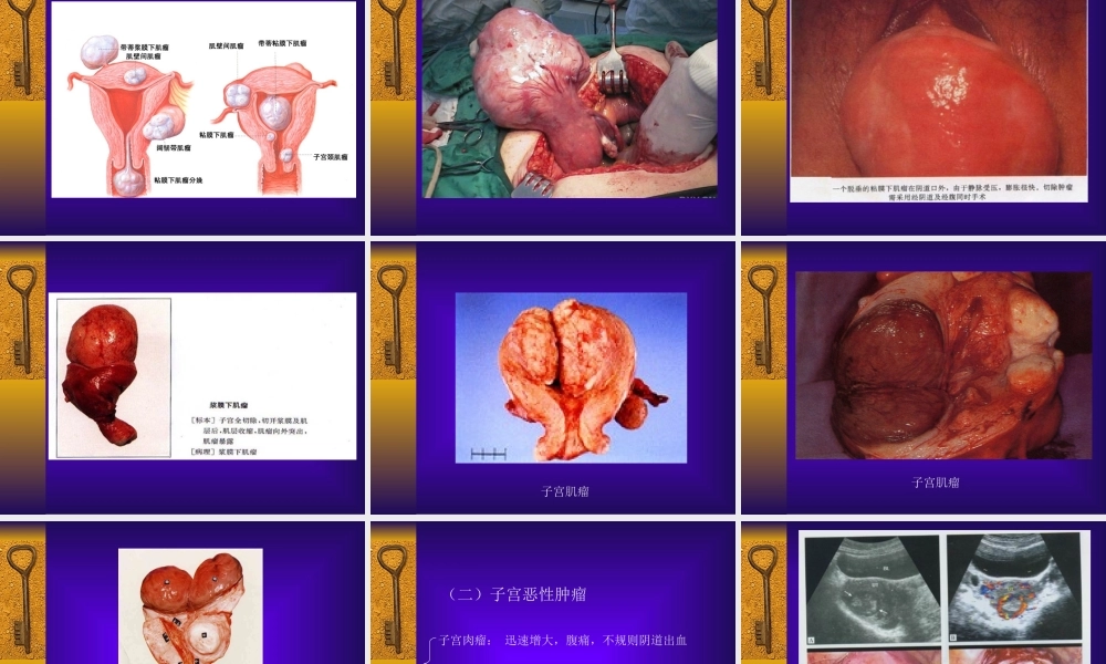 妇科-盆腔肿块.ppt