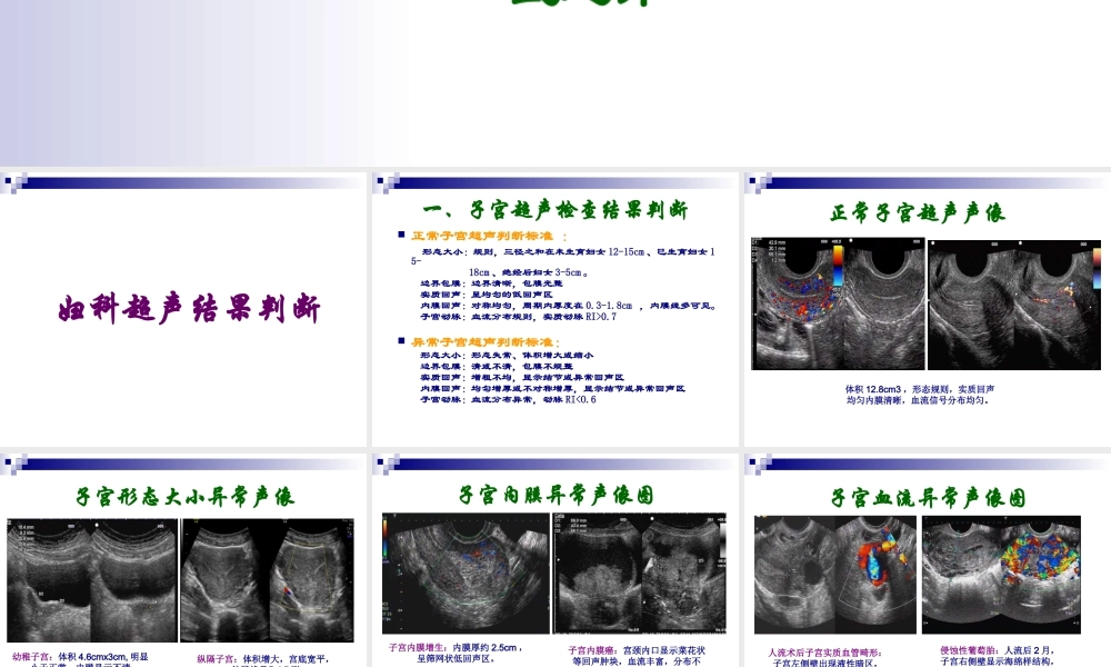 妇科超声常规检查风险评估-(NXPowerLite).ppt