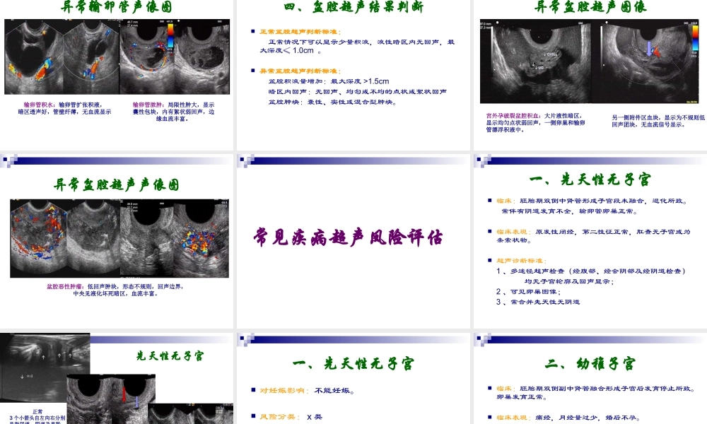 妇科超声常规检查风险评估-(NXPowerLite).ppt