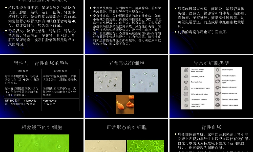 尿液有形成分yiyi.ppt