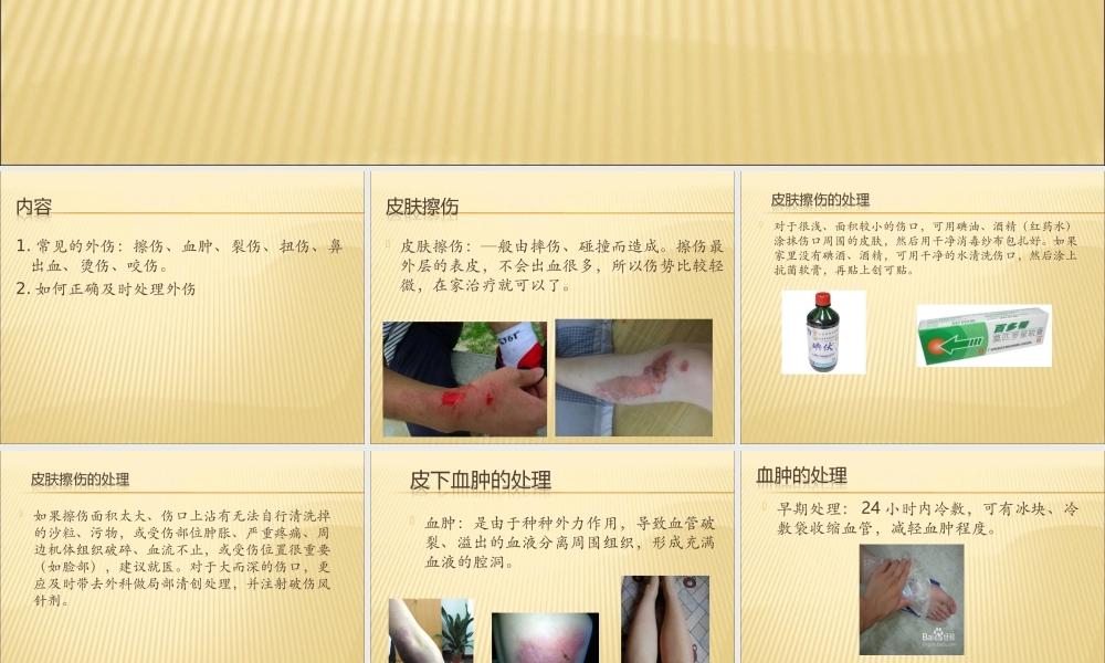 常见外伤处理方法.ppt