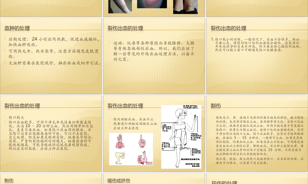 常见外伤处理方法.ppt