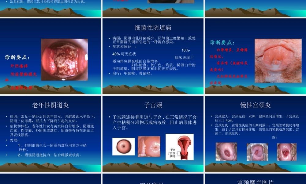 妇科常见病知识讲座.ppt