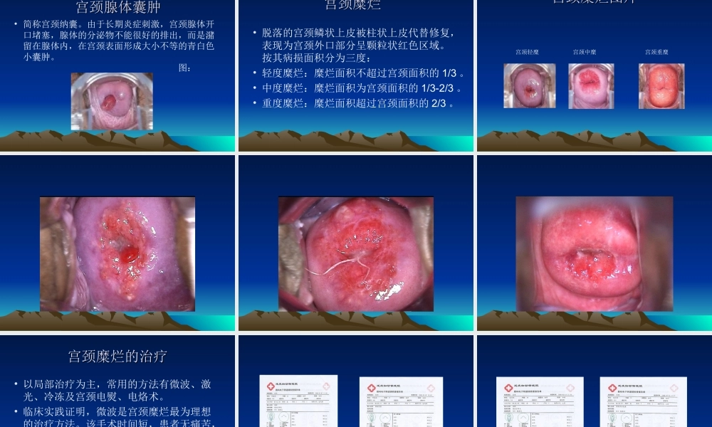 妇科常见病知识讲座.ppt
