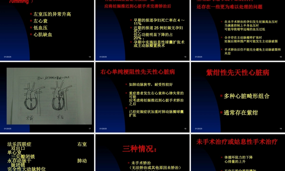 妊娠合并心脏病的外科干预策略和预后.ppt