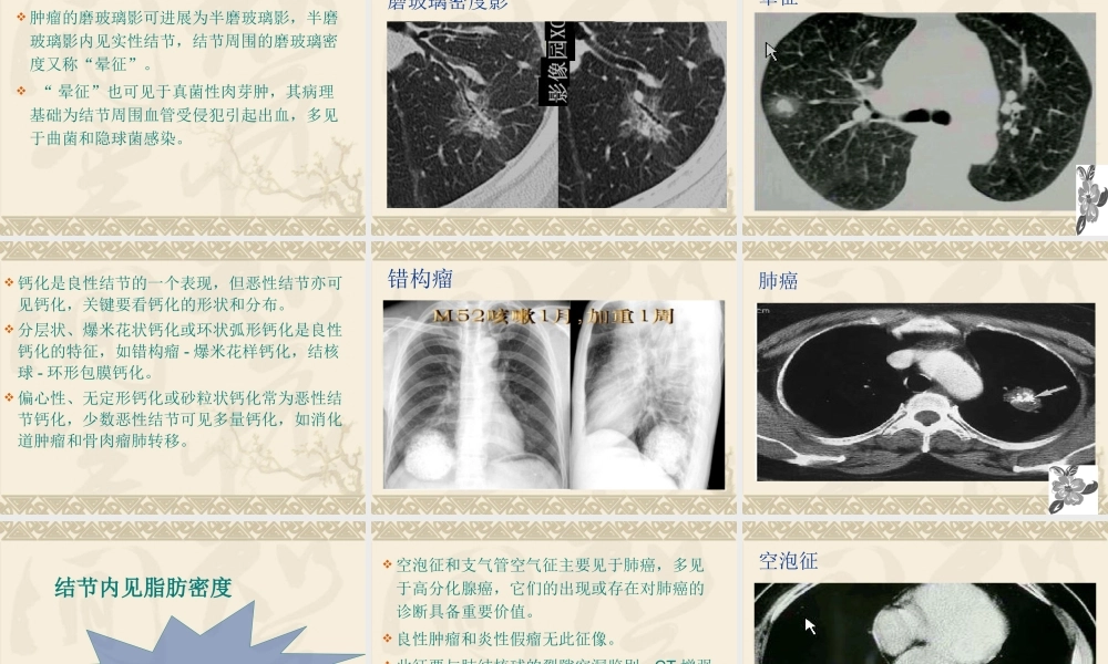 孤立性肺结节.ppt