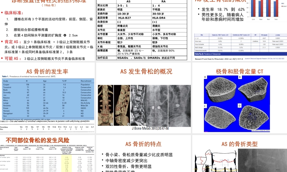 强直性脊柱炎与骨质疏松.pptx