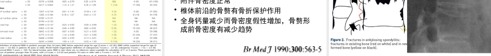 强直性脊柱炎与骨质疏松.pptx
