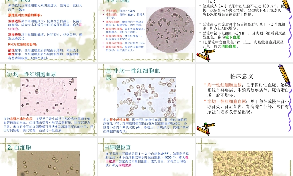 尿液有形成分检查.ppt