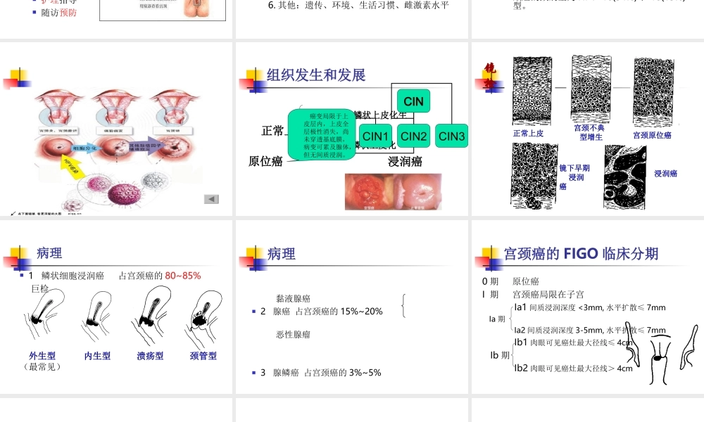 宫颈癌.ppt胡.ppt