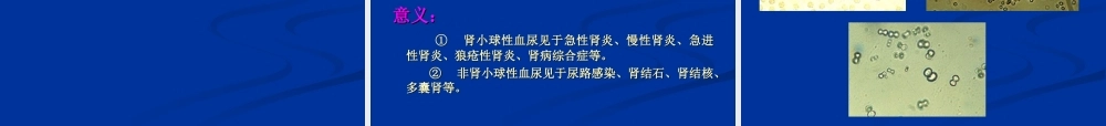 尿液、粪便检查剖析.ppt