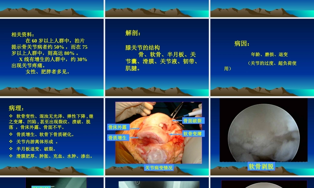 常见膝痛的骨科诊治.ppt