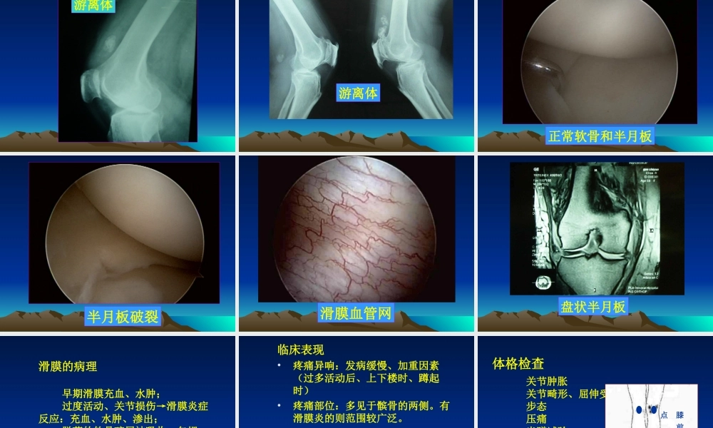 常见膝痛的骨科诊治.ppt