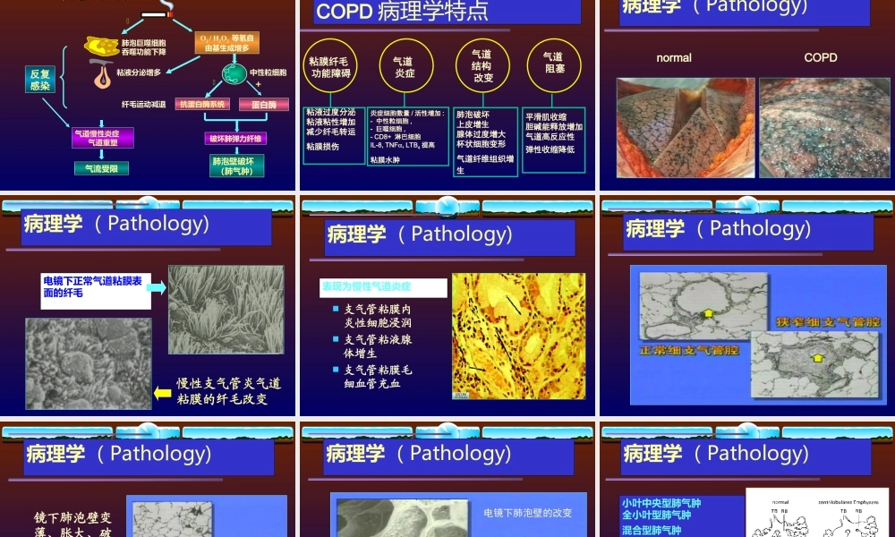 慢性阻塞性肺病12.ppt