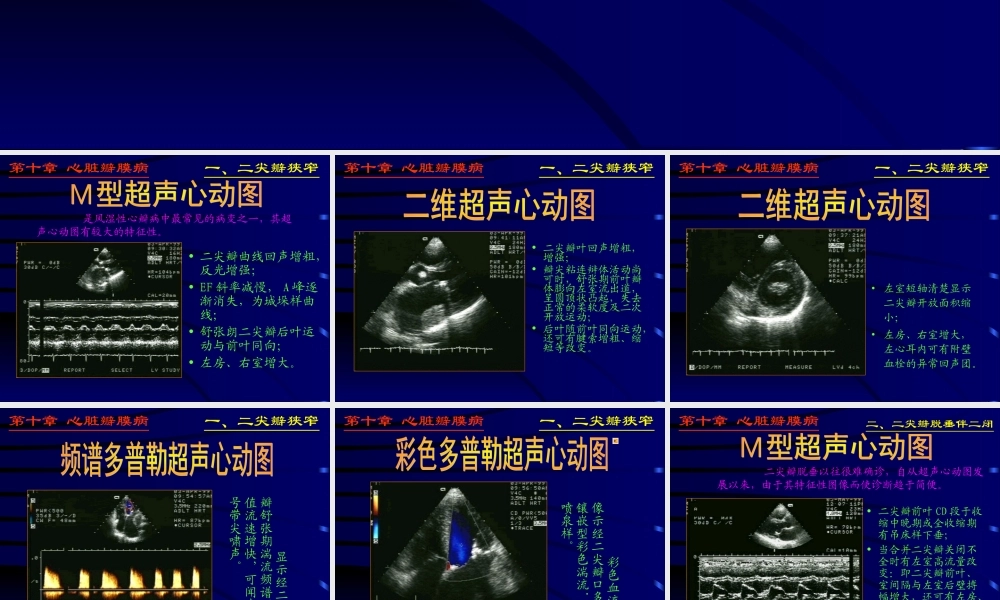 异常心脏ppt.ppt