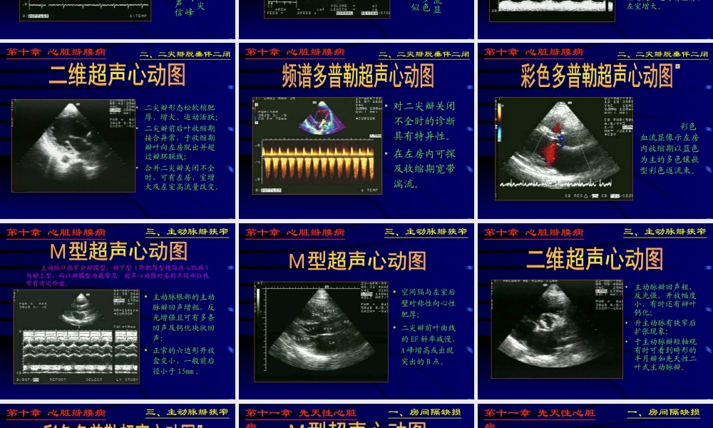 异常心脏ppt.ppt