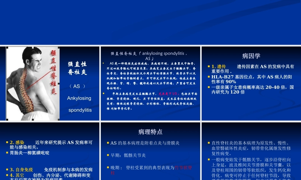 强直性脊柱炎.pptx
