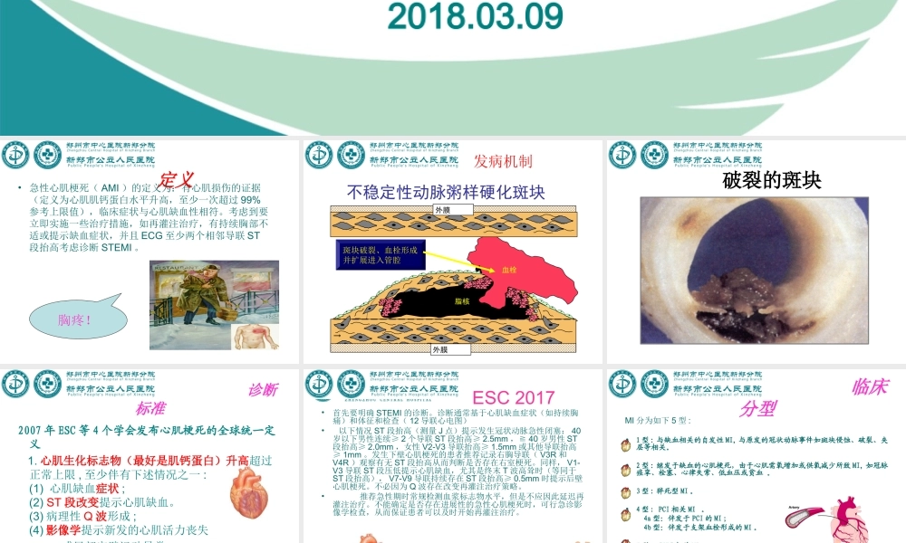 急性ST段抬高型心肌梗死-2017指南.ppt