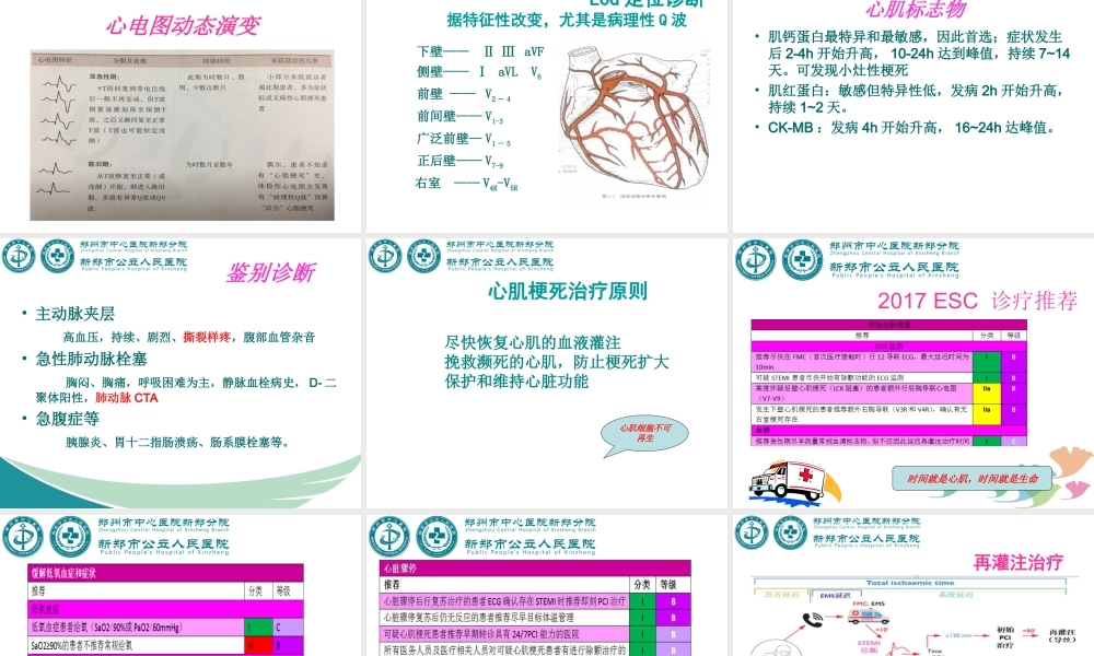 急性ST段抬高型心肌梗死-2017指南.ppt