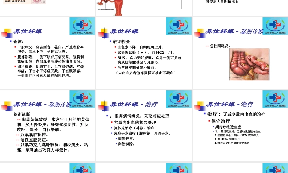 妇科急腹症概述.ppt