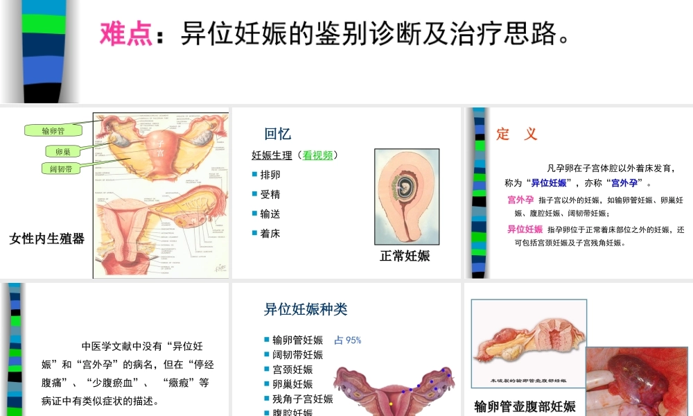 妊娠病异位妊娠.ppt