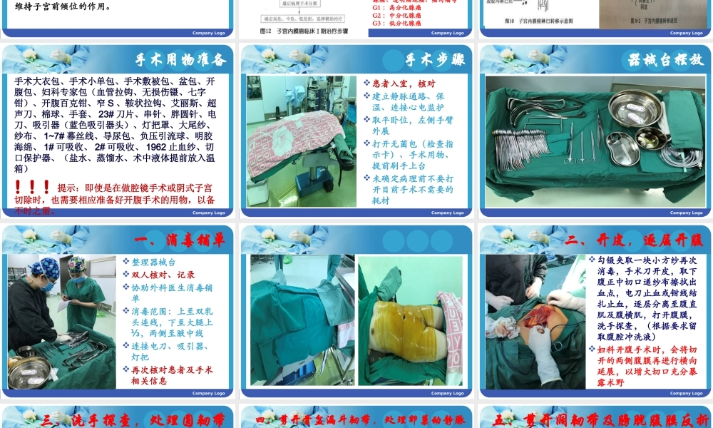 子宫内膜癌的手术配合.pptx