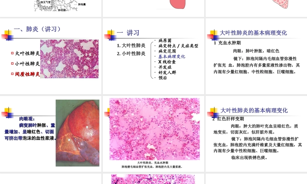 实习10-慢支炎、肺气肿、肺心病、肺炎.ppt