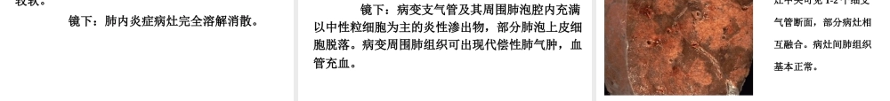 实习10-慢支炎、肺气肿、肺心病、肺炎.ppt
