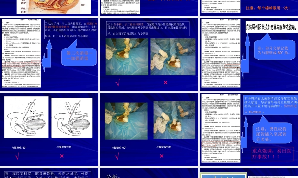 导尿及注意事项..ppt