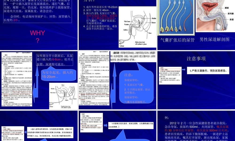导尿及注意事项..ppt
