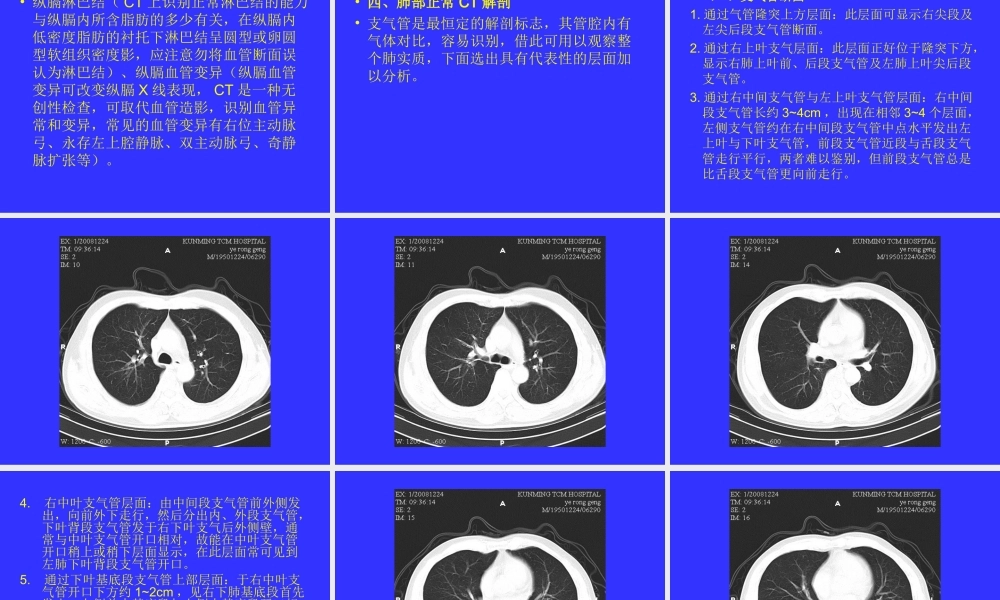 如何读懂胸部CT.ppt