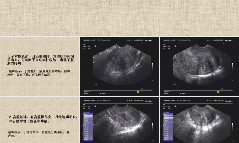 妇科常见急腹症.ppt