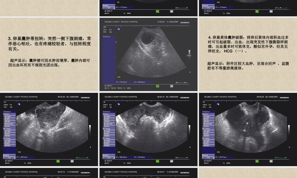 妇科常见急腹症.ppt
