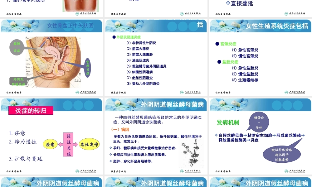 妇科炎症概述.ppt