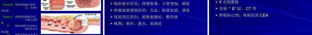 山大-结肠直肠癌.ppt