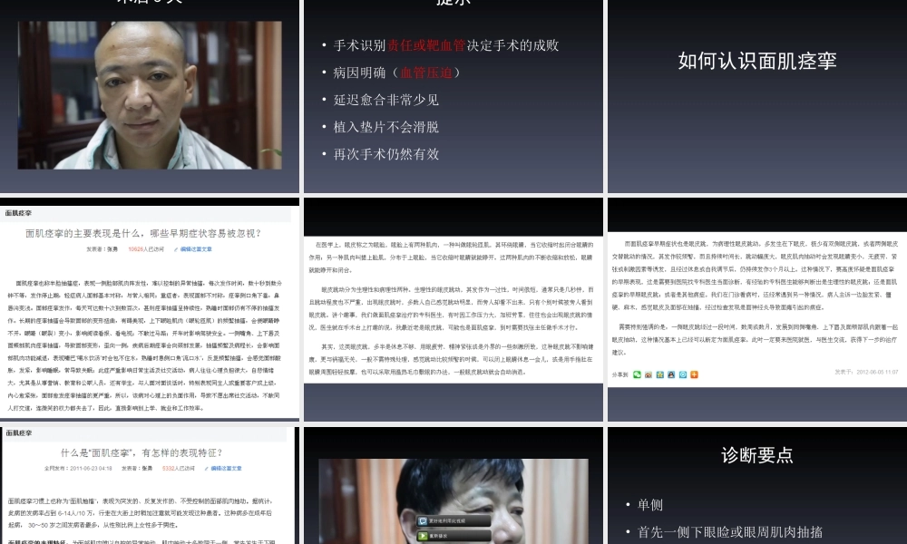 张勇医生(神经外科主任)讲解面肌痉挛.ppt